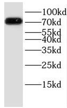 HLCS Antibody