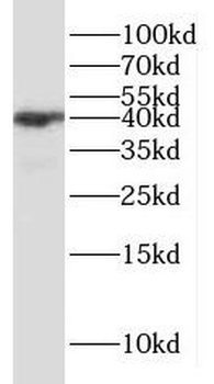 HMBS Antibody