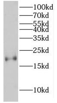 HMGA2 Antibody