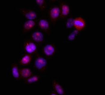 HMGB1 Rabbit Polyclonal Antibody