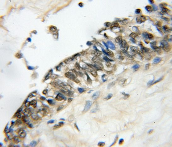 HMGB1 Rabbit Polyclonal Antibody