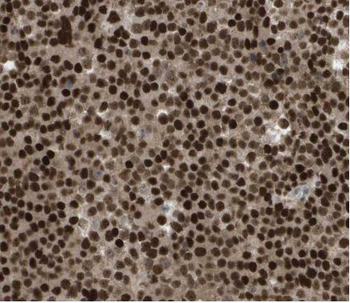 HMGB2 Rabbit Polyclonal Antibody
