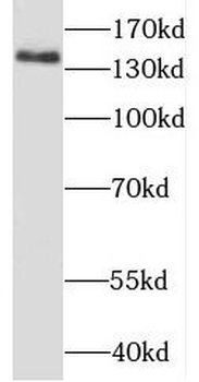 ARHGAP45 Antibody