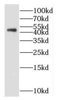 HNF4G Rabbit Polyclonal Antibody