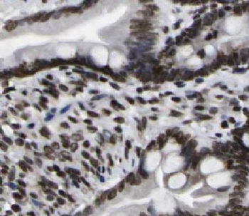 HNF4G Rabbit Polyclonal Antibody