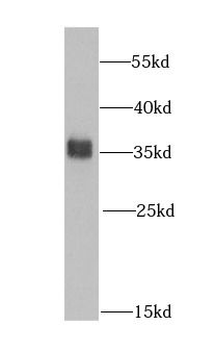 HNRNPA0 Antibody