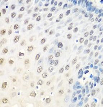 HNRNPA0 Rabbit Polyclonal Antibody