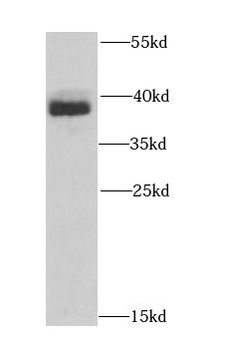 HNRNPA1 Rabbit Polyclonal Antibody