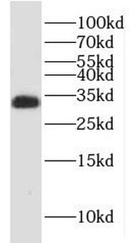 HNRNPC Rabbit Polyclonal Antibody