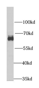 HNRNPL Rabbit Polyclonal Antibody