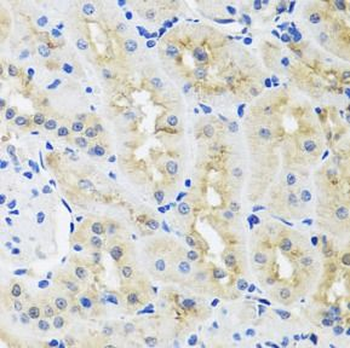 HNRNPL Rabbit Polyclonal Antibody