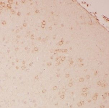 HOMER1 Rabbit Polyclonal Antibody