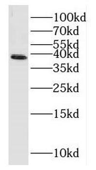 HOMER2 Antibody