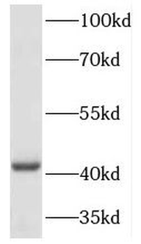 HOXA2 Antibody