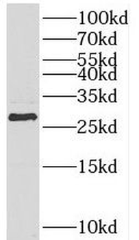 HOXB7 Antibody