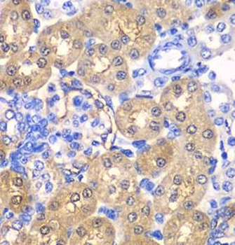 HPD Rabbit Polyclonal Antibody