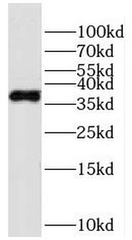 HPDL Antibody