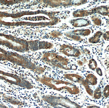 HPDL Rabbit Polyclonal Antibody