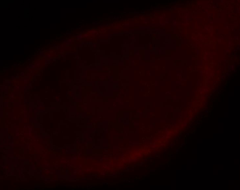 HPRT1 Rabbit Polyclonal Antibody
