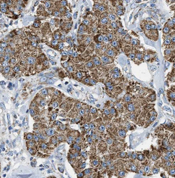 HPS3 Rabbit Polyclonal Antibody