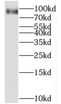 HPS4 Rabbit Polyclonal Antibody