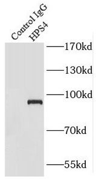 HPS4 Rabbit Polyclonal Antibody