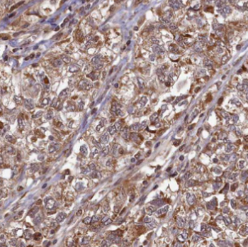 HPS6 Rabbit Polyclonal Antibody