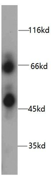 HPSE Rabbit Polyclonal Antibody