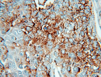 HPSE Rabbit Polyclonal Antibody