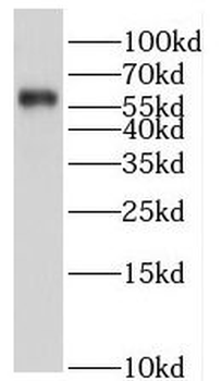 HPSE Rabbit Polyclonal Antibody