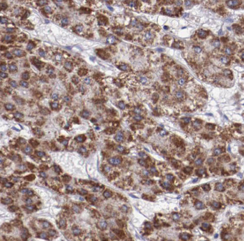 HPSE Rabbit Polyclonal Antibody