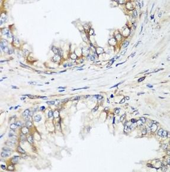 HPSE2 Rabbit Polyclonal Antibody