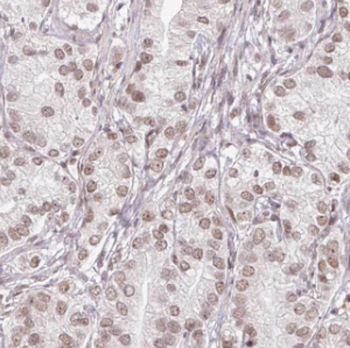 HSBP1 Rabbit Polyclonal Antibody