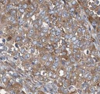 HSPA8 Rabbit Polyclonal Antibody