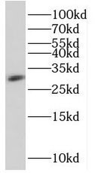 HSCB Antibody