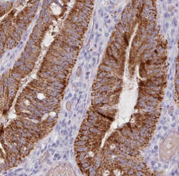 HSCB Rabbit Polyclonal Antibody