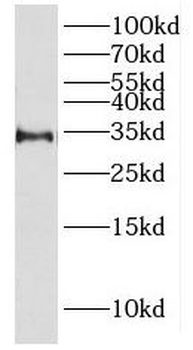 HSD17B6 Antibody