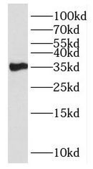 HSD17B7 Antibody
