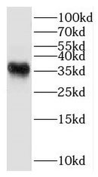 HSD3B7 Antibody