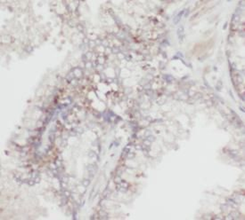 HSDL2 Rabbit Polyclonal Antibody