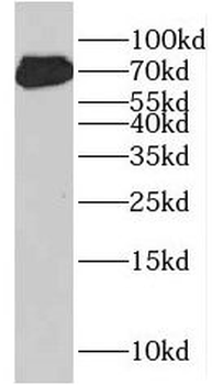 HSF1 Rabbit Polyclonal Antibody