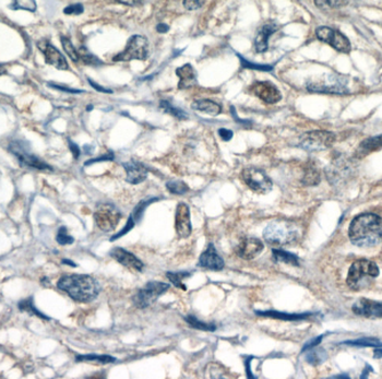HSF1 Rabbit Polyclonal Antibody
