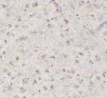 HSPA1A Rabbit Polyclonal Antibody