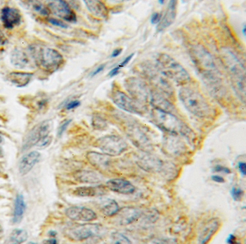 HSPA13 Rabbit Polyclonal Antibody