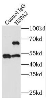 HSPA2 Rabbit Polyclonal Antibody