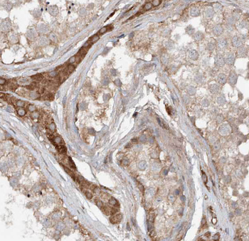 HSPA2 Rabbit Polyclonal Antibody
