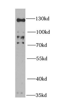 HTATSF1 Antibody