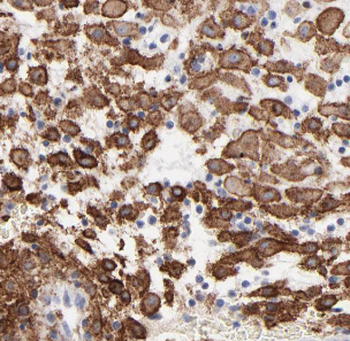 HTRA1 Rabbit Polyclonal Antibody