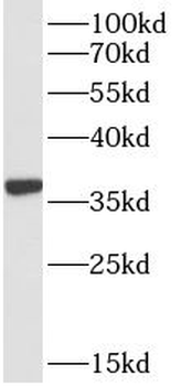 HTRA2 Rabbit Polyclonal Antibody