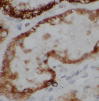 HTRA2 Rabbit Polyclonal Antibody